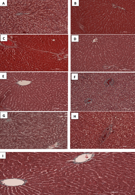 (A–I) Photomicrograph of the liver sections stained with Masson Trichrome (MT). ...