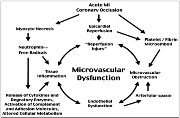 Pathophysiology of microvascular dysfunction post AMI.