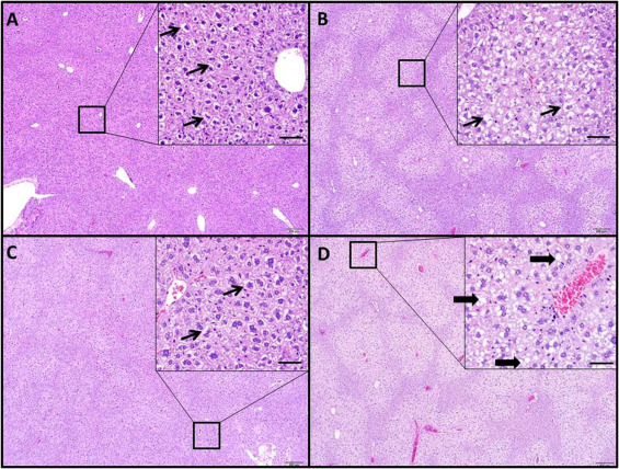 Increased hepatotoxicity seen with PCB126 in MTKO animals.WT and MTKO animals ...
