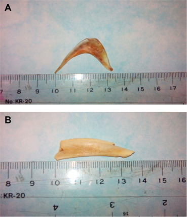 (A) A crescent-shaped fish bone with a sharp, pointed end and edge 3.5 cm × 1 cm ...