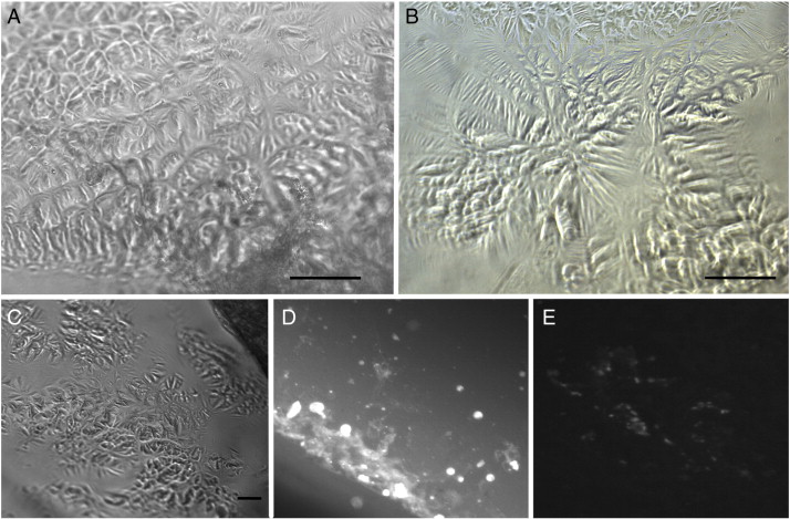 Cultivated human endothelial cells. Adherent endothelial cells were obtained ...