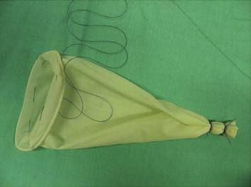 The fingers of the sterile glove were cut off and the button of the sterile ...