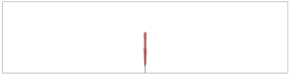 Local model. Advanced stage.