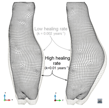 Deformed shape of an AAA considering the material properties given in Table 13 and subjected to a blood pressure of 71.5mmHg (9.53kPa). Two different healing rate parameters k have been considered in addition to an irreversible stiffness  loss parameter ξ=0. The distal and proximal extents were excluded from damage and assigned a hyperelastic material behaviour.   Real deformation (×1) is plotted.