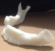 Partial jaw model.\label{F4b}