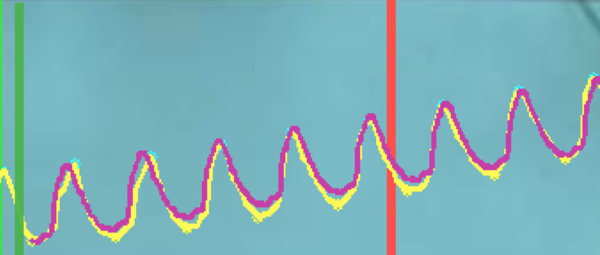 Curva construida con los promedios de los coeficientes de Fourier para 5 ciclos