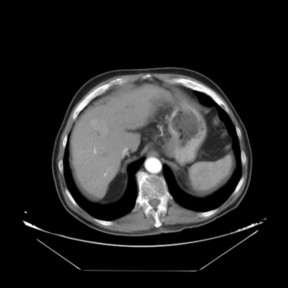 Arterial phase (reference dataset, R)