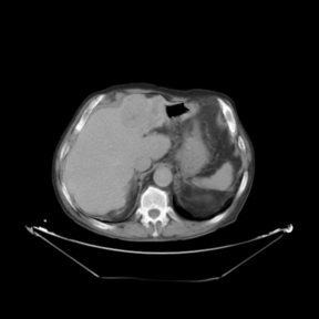 Registered template, T_u (proposed method)