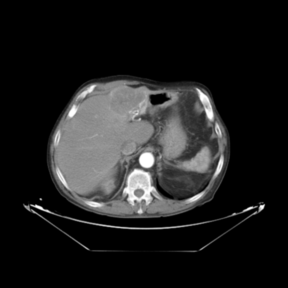 Arterial phase (reference dataset, R)