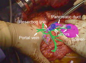 Draft Samper 627449012-image13.png