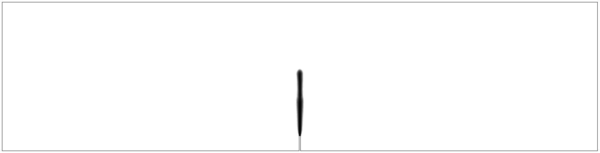 Local model. Advanced stage.